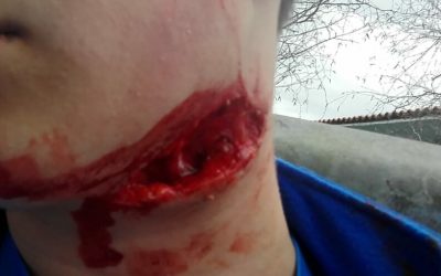 Puede matar. Alerta BI 3341 de la Diputación Foral de Bizkaia.